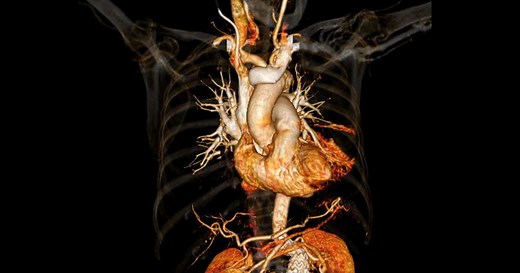 Artère mésentérique : fonctions, maladies et traitements