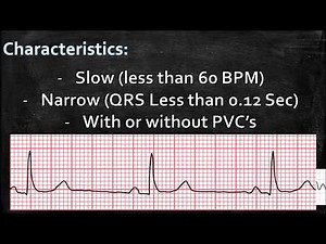 RHYTHM PRACTICE ACLS Rhythm and Tx: Sinus Bradycardia
