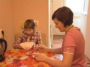 РТ синдром Ретта