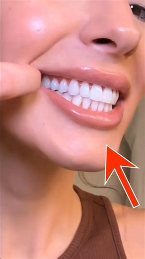 Trick To Get White Teeth 😨 #shorts