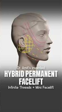 This Facelift Changes Everything About Recovery #facelift #beforeandafter #trending