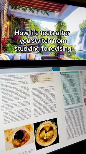 Not really a secret now😉 #studytok #spacedrepetition #studytips #activerecall #studymotivation #studyhack #studywithme #academicweapon #exam