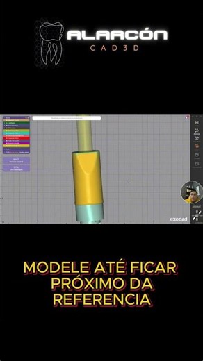 Scanbody for 3D Printing? This Tip Is Worth Its Weight in Gold #3dprinting #dentalcaddesign #exoc...