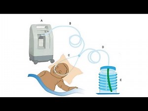 How to Use CPAP & Newborn Emergency Support Step by Step| Neonatal care |