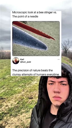 Microscopic look at a bee stinger vs.The point of a needle