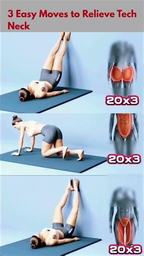 3 Easy Moves to Relieve Tech Neck & Shoulder Pain Fast #TechNeck #NeckPain #Shorts