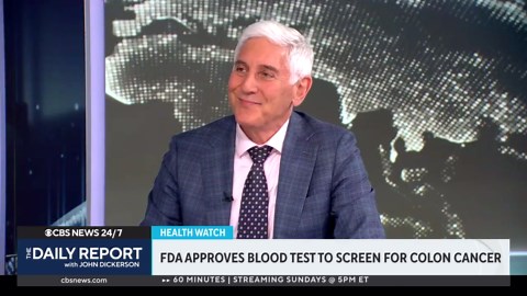 What to know about the FDA-approved blood test for colon cancer detection