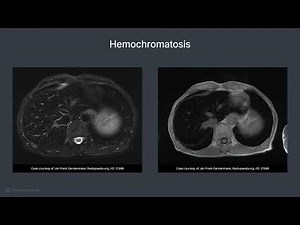 MRI Cross Sectional Anatomy - Common Abdominal Pathologies