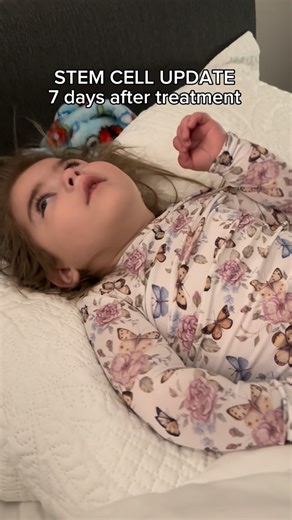 Alexa on Instagram: "It’s been 7 whole days since Lydia finished her 2nd round of stem cells. A full week. This is day 7 post-op, but the stem cells are given in four separate doses of roughly 10 million mesenchymal donor umbilical cord cells. 40 million total, 4 days to administer them. That’s important.** This is our 2nd with our 1st being six months ago. During the first round I started noticing some positional changes by our third infusion (aka 3rd day). Granted, I thought I was losing my mi