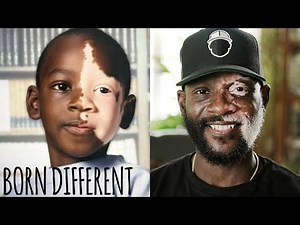 I Used To See A ‘Monster’ In The Mirror | BORN DIFFERENT