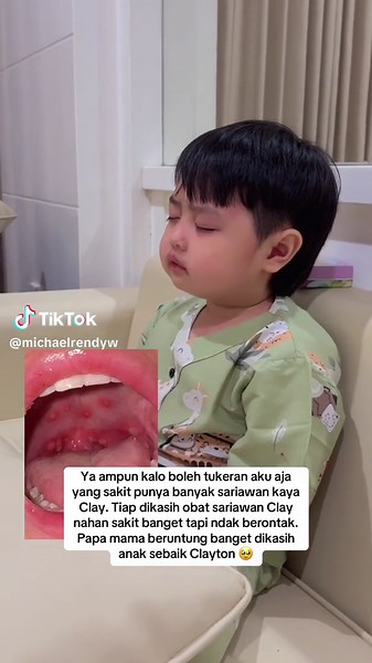 Semangat Clayton yang Kena HFMD - Kisah Perjuangan Mama dan Papa