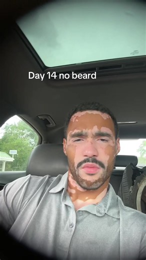 Carlo (@lo.gambino)’s video of Growing A Beard