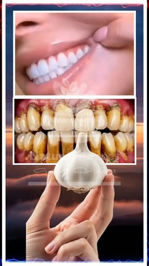 The Perfect Tooth Brushing Routine: A Guide to a Healthier Smile Achieve a sparkling smile with our ultimate tooth brushing guide! 🦷✨ Discover the secrets to proper brushing techniques, the best types of toothbrushes and toothpaste, and tips for maintaining oral hygiene. Watch now to ensure your teeth are as healthy as they are beautiful! #OralHygiene #HealthySmile #toothbrushingtips | Natural Recipes