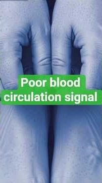 7 Early Signs of Poor Blood Circulation You Shouldn’t Ignore, #Poorbloodcirculation