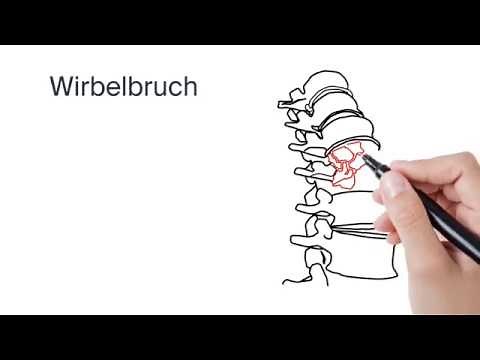 Behandlung Wirbelbruch (by ATOS Kliniken)