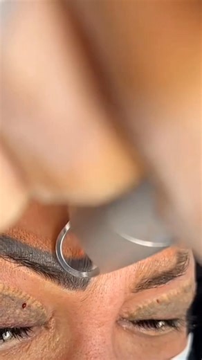 Eyebrow tattoo removal laser treatment | Meenu Saini