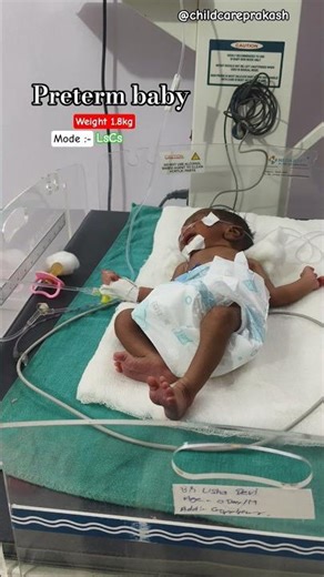 Mini vlog with premature babies #weight1.8kg #nicu #nicuwarrior #cute #adoreble #baby