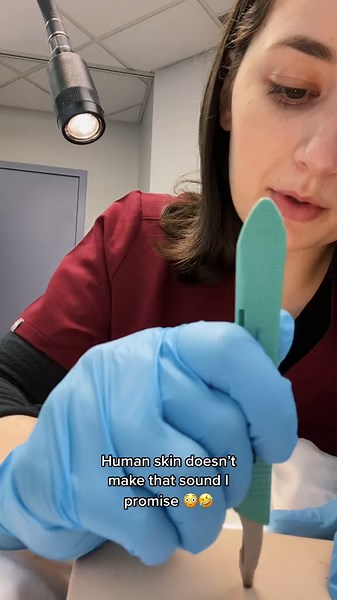 Nexplanon Removal Procedure POV
