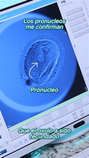 ✨Así son los primeros días de un #embrión visto desde el embryoscope plus... . . @doctorvelit Logrando #embarazos imposibles | Doctor Marcelo Velit