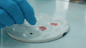 Medical development laboratory: female scientist is looking in the microscope, and analyzing blood types. People do medicine research in laboratories