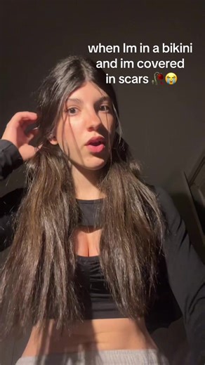 Scars and the Bikini Confidence Journey