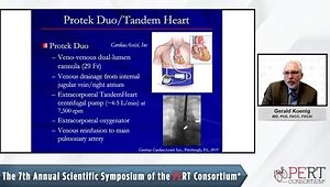 Mechanical Circulatory Support in Acute Pulmonary Embolism: Device Options