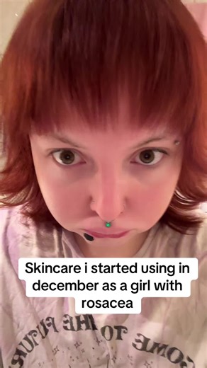 Finacea has not worked on me before but the doctors wanted to try it again before trying some other treatment😁 #rosacea#skincare#rosaceaskincare#fyypp