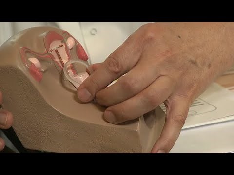 Contraception: Is the vaginal ring an alternative to the pill? - Allô Docteurs