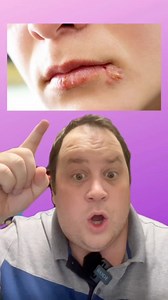 22K views · 238 reactions | Health vocabulary #LearnEnglish | English Lingo | Facebook