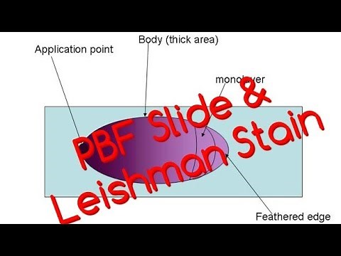 PBF~ Blood Smear & Leishman Staining Procedure