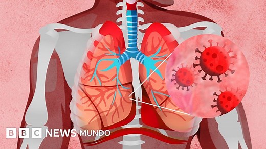 Coronavirus: ¿qué le hace el covid-19 al cuerpo? - BBC News Mundo