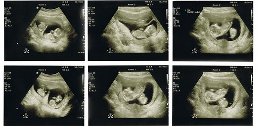 Researcher claims CRISPR-edited twins are born. How will science respond?