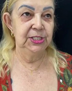 🚨TOME A DECISÃO DE MUDAR seu sorriso como Dona Vera fez. Muitas pessoas ainda não procuraram porque acreditam que não terão condições. Os planos de pagamentos são muito acessíveis hoje em dia! Clique em ENVIAR MENSAGEM E tire suas dúvidas sobre a Prótese Protocolo 💪🏻👏 Para quem tem esse desejo de recuperar os dentes , realizar o seu sonho.🎉👏 VOCÊ GOSTARIA de uma das vagas de janeiro ?😊 Então faça assim : 1- deixe seu número de Whats ( com ddd) aqui nos COMENTÁRIOS . 2- ou comente EU QUERO