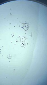 Exploring Microscopic Life: The World We Can't See