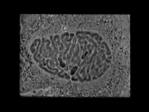 La division cellulaire ou mitose