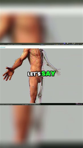 Acupuncture for Sciatic Pain - Needle Placement Explained