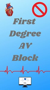 🫀🫀 First degree heart block 🫀🫀 Comment below 👇 did I miss anything you would add? #paramedic #nurse #paramedicscience #nursingstudent #nursingstudentlife #studentnurse #studentparamedics #studentparamedic #paramediclife #paramedicstudent #emergencymedicine #ems #emslife #medicine #medlife #paramedicscience #emtstudent #emtlife #emergencymedicalservices #emergencymedicaltechnician #studentemt #phem #emergencyhealthcare #prehospitalcare | The Medical Lounge