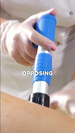 SoftWave vs. Traditional Shockwave Therapy - SofWave Therapy in Arlington Heights IL #SoftWave