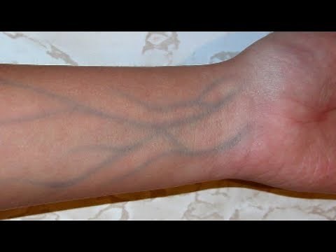 5 Signs Of Poor Blood Circulation That You Shouldn't Ignore