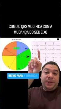How to determine the cardiac axis on an electrocardiogram? #ecg