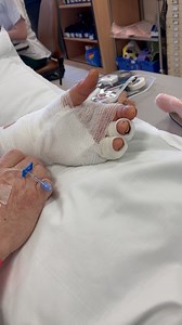 Following a horrific accident at work, RDH patient, Christopher, praises the team who performed extensive surgery to reattach his hand, with miraculous results! ✨ “Whilst working on a machine, the chains grabbed my overalls and pulled my hand in. I heard a snap and I knew I had lost my hand." "There are no words that can express how thankful I am to all of the teams that have cared for me." Read Christopher's full story here: bit.ly/HandPatient #TeamUHDB #NHS #Patientstories | University Hospita