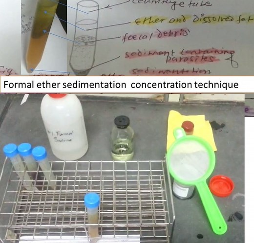 Concentration Techniques : Introduction, Principle, Types, Test Procedure
