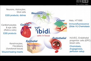 08臻和-易必迪ibidi 细胞趋化性(2D或3D)/chemotaxis HT1080