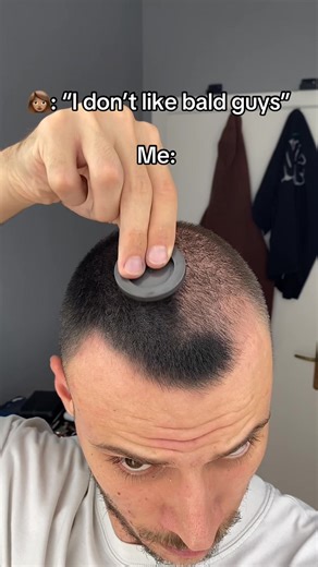 She said she doesn’t like bald guys. That’s okay — because you’re not one anymore. RIZEN™ gives you instantly thicker, natural-looking hair that stays flawless through rain, sweat, and long days. 🔥 Limited Time: 2 1 FREE — your comeback starts now. | Rizen