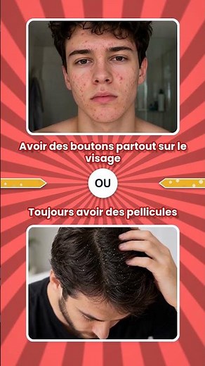 🤔🔥 #48 Tu préfères quoi ? — 7 dilemmes impossibles #tupreferes #wouldyourather #shorts #challenge
