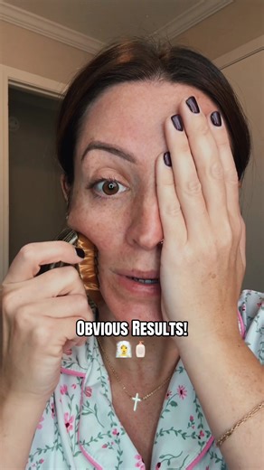 Incredible Results of Dry Brushing Your Skin