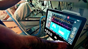 'Post intensive-care syndrome': Why some COVID-19 patients may face problems even after recovery