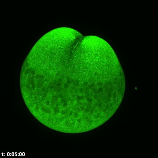 Your samples deserve to be seen in super resolution and at scale. The Evident IXplore™ Spin family delivers fast, reliable live-cell imaging tailored to your experiment. From IXplore Spin to SpinSR and SpinXL, the platform pairs speed, sensitivity, and stability with seamless system integration. The IX85 real-time controller synchronizes every component with microsecond precision, enabling reproducible imaging even in complex live-cell experiments. For applications that demand more, IXplore Spin