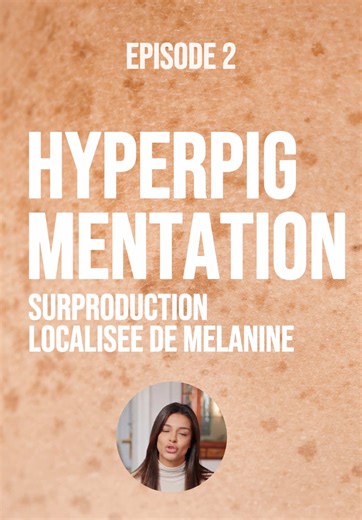 Hyperpigmentation: Conseils pour une peau éclatante