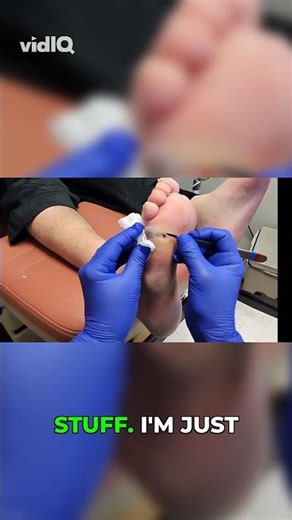 Open Wound & Callus - Do I Need a Doctor? 👣 | Foot Health, Infection Risk, Podiatry